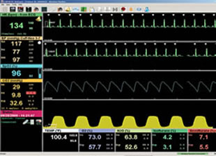 Vmed Bluetooth Wireless Veterinary Monitors