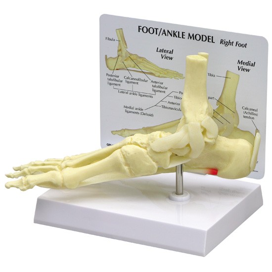 Foot/Ankle - Plantar Fasciitis