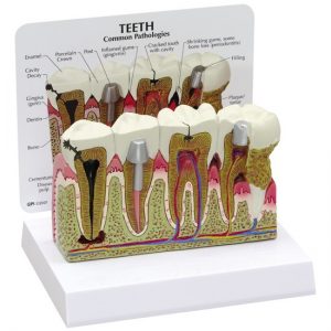 Human Teeth - 2860