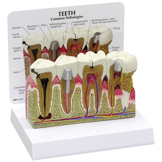 Human Teeth