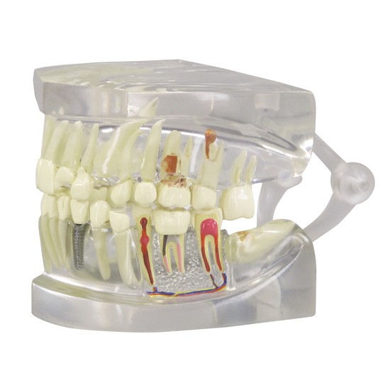 Clear Human Jaw W/ Teeth Clear Human Jaw W/ Teeth